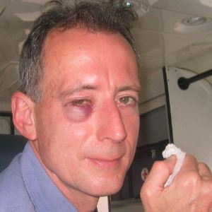 Peter Tatchell attacked